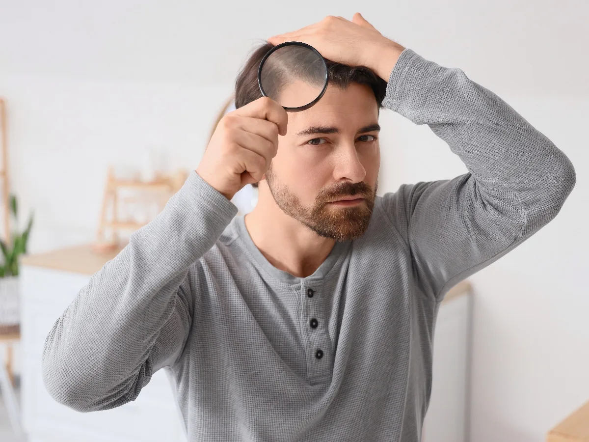 Hombre revisando con una lupa la pérdida de cabello en la zona de las entradas